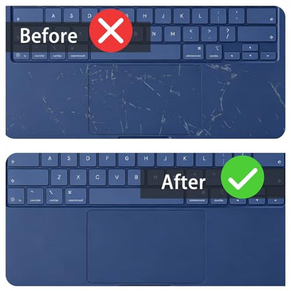 Palm Rest Skin for 2026 MacBook Neo 13 inch Laptop with A18 Pro Chip A3404, MacBook Neo Accessories Wrist Rest Protective Skin Cover Scratch Resistant (Blue)