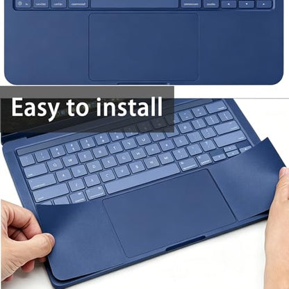 Palm Rest Skin for 2026 MacBook Neo 13 inch Laptop with A18 Pro Chip A3404, MacBook Neo Accessories Wrist Rest Protective Skin Cover Scratch Resistant (Blue)