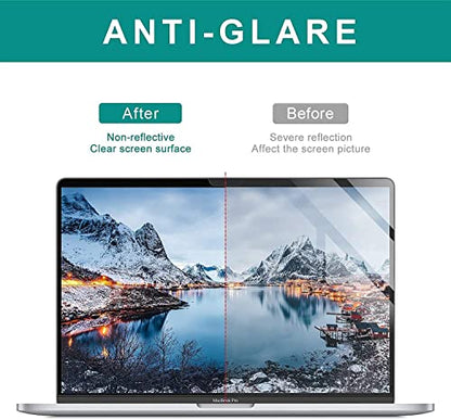 ZOEGAA MacBook Pro 14 Inch Screen Protector 2021-2026, Eye Care Anti Blue Light & Anti Glare Screen Protector, Compatible with MacBook Pro 14.2 Inch (M5, M4, M3, M2, M1,Pro,Max,Chip) - size: MacBook Pro 14.2 inch