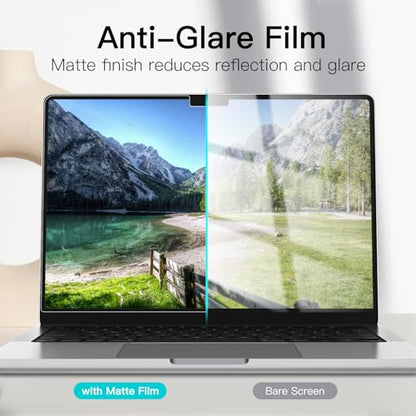 JETech Screen Protector for MacBook Pro 14-Inch (M1-M5, 2021-2026), Anti-Glare PET Matte Film, Anti-Fingerprint, 2-Pack - size: MacBook Pro 14 Inch (2021-2026)