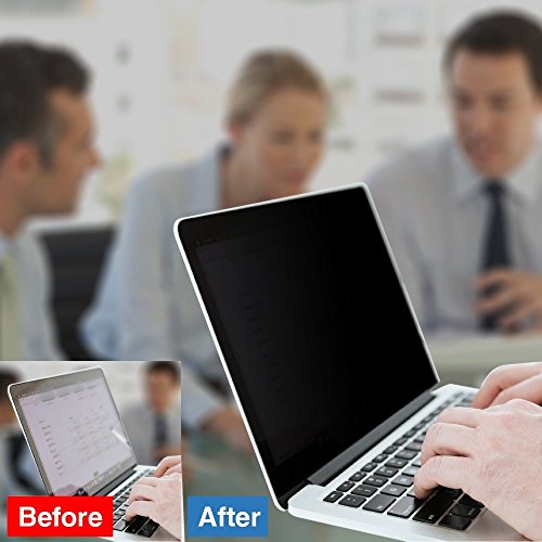zyphonic Magnetic Privacy Screen Protector Compatible with MacBook Pro 14 inch 2026 M5 M4 M3 M2 M1 Pro/Max, Removable Anti Spy Blue Light Glare Shield