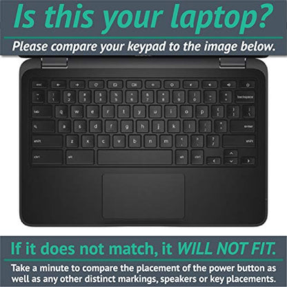 MightySkins Skin Compatible with Dell Chromebook 11" 3180 - Hipster | Protective, Durable, and Unique Vinyl Decal wrap Cover | Easy to Apply, Remove, and Change Styles | Made in The USA - color: Hipster