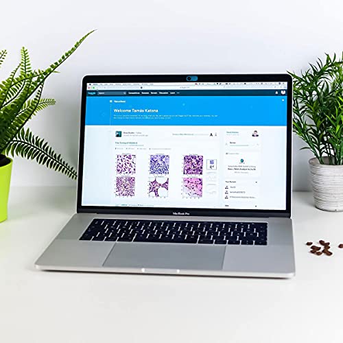CloudValley Laptop Camera Cover Slide, Metal 0.023 Inch Ultra-Thin, 2 Pack | Webcam Cover for MacBook Pro / Air, Laptop, iMac, iPad, iPhone 8/7, PC Accessories, Privacy Web Camera Protection, Blue - color: Blue-2 Pcs